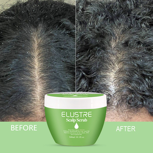 OEM Moisturizing Anti-Frizz Fluffy Scalp Scrub for Oily Scalp Dandruff Control | Deep Cleansing Detox | Exfoliating Treatment